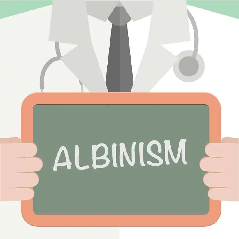 Marijuana albinism and its effect. Chalkboard with albinism on it.
